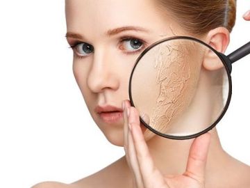 6 bí quyết chăm sóc da khô ngày Đông
