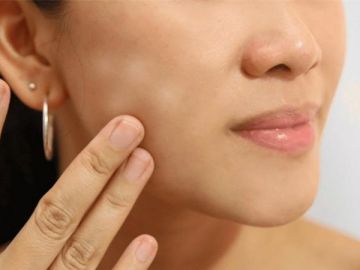 Giải quyết triệt để các vấn đề về da một cách đơn giản