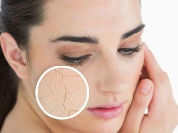Bí quyết chăm sóc da khô, bạn cần học ngay hôm nay