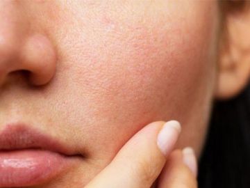 Bí quyết giúp bạn thu nhỏ lỗ chân lông tại nhà