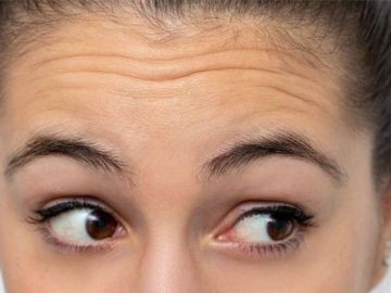 Cách giúp bạn loại bỏ nếp nhăn trên trán