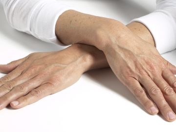 Da tay bị lão hóa sớm phải làm sao?