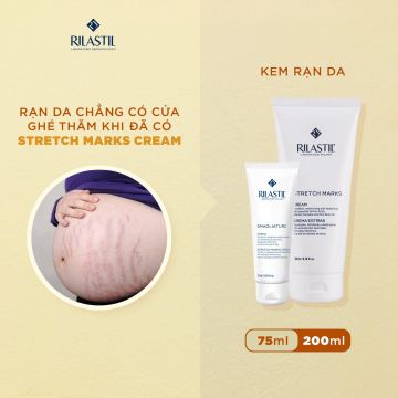 RẠN DA CHẲNG CÓ CỬA GHÉ THĂM KHI ĐÃ CÓ STRETCH MARKS CREAM