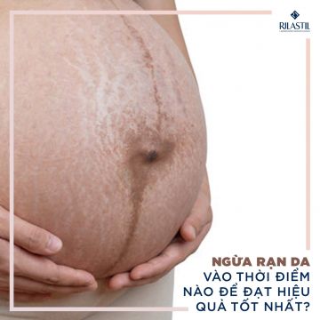 NGỪA RẠN DA VÀO THỜI ĐIỂM NÀO ĐỂ ĐẠT HIỆU QUẢ TỐT NHẤT?