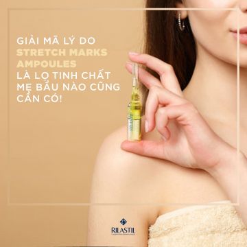 VÌ SAO STRETCH MARKS AMPOULES LÀ ỐNG TINH CHẤT MẸ BẦU NÀO CŨNG CẦN CÓ ?