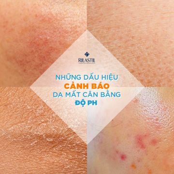 NHỮNG DẤU HIỆU CẢNH BÁO DA BỊ MẤT CÂN BẰNG ĐỘ PH