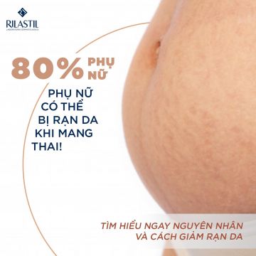 TÌM HIỂU NGAY NGUYÊN NHÂN VÀ CÁCH PHÒNG RẠN DA