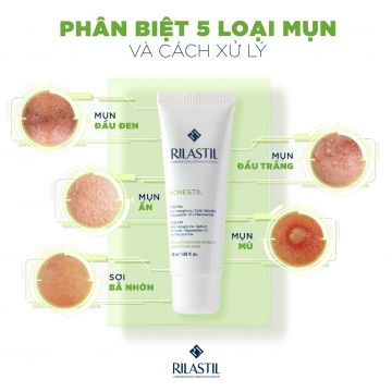 PHÂN BIỆT 5 LOẠI MỤN VÀ CÁCH XỬ LÝ VỚI RILASTIL