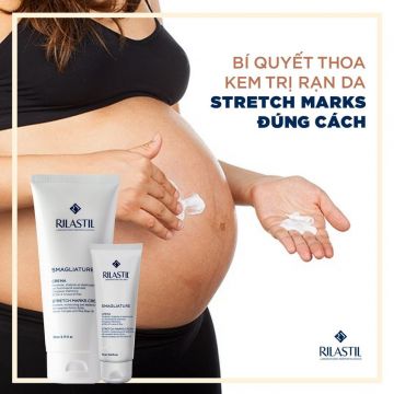 BÍ QUYẾT THOA KEM TRỊ RẠN DA STRETCH MARKS ĐÚNG CÁCH