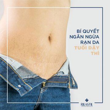BÍ QUYẾT NGĂN NGỪA RẠN DA TUỔI DẬY THÌ