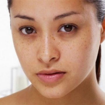 4 cách chữa thâm mắt tại nhà bạn cần ghi nhớ