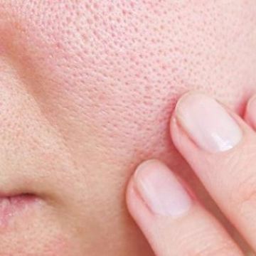 Da luôn bóng nhẫy đổ dầu, vì đâu?