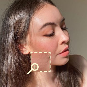 Tất tần tật những điều cần biết khi dùng retinol vào mùa hanh khô để tránh da bị kích ứng