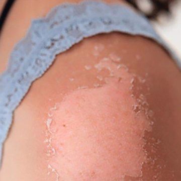 Làm sao để làn da “sống sót” khi tia UV ở mức báo động?