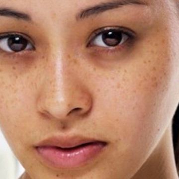 Nguyên nhân không ngờ khiến làn da không đều màu
