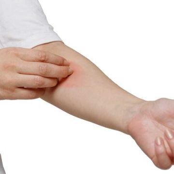 Tại sao da bạn nhạy cảm với quần áo?