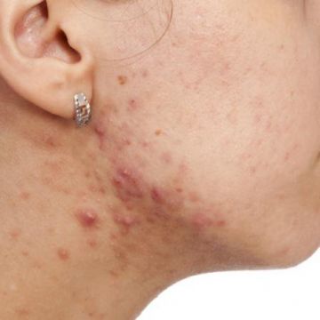 Tác hại của mỹ phẩm giả