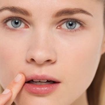 Tăng sản bã nhờn: Triệu chứng, nguyên nhân và điều trị