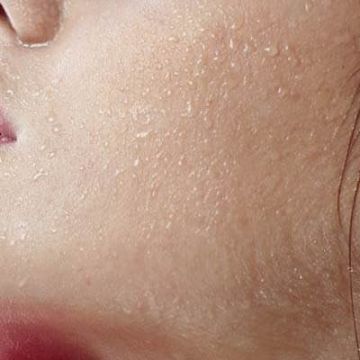 Da khô nghiêm trọng: Nguyên nhân, cách khắc phục và phòng ngừa