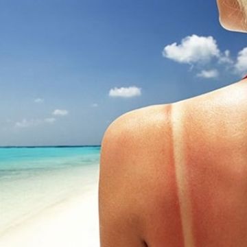 5 thực phẩm cứu làn da cháy nắng