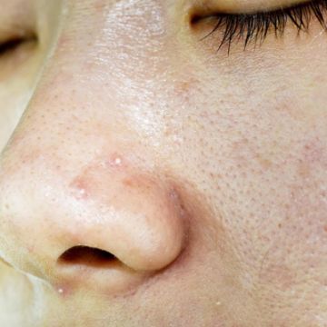 Lời khuyên làm đẹp dành riêng cho người da dầu