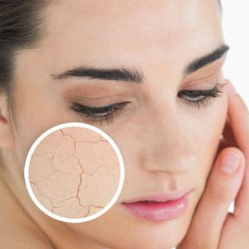 Bí quyết để da không khô, nứt nẻ ngày hanh khô