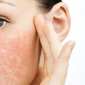Thói quen khiến làn da nhạy cảm tổn thương