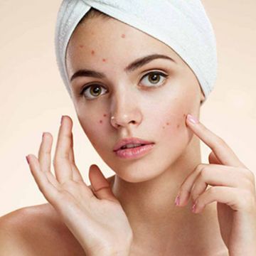 Thủ phạm gây mụn trứng cá không phải ai cũng biết